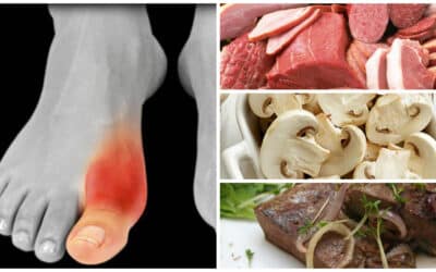 Consumo de pulpo y gota: causas y recomendaciones