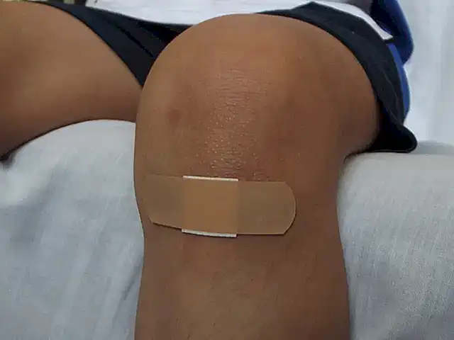 Las heridas causadas por los pulpos son generalmente poco profundas y se pueden tratar fácilmente