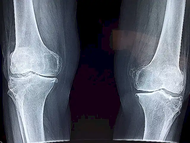 Promueve la salud ósea